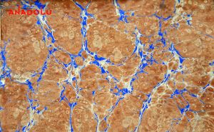 Ebru Örnekleri Balıkesir